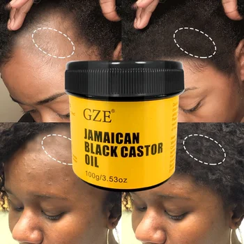 GZE JAMAICAN Black Castor Oil Pure Cold-Pressed für Haarwachstum, Hautfeuchtigkeit und Kopfhautgesundheit