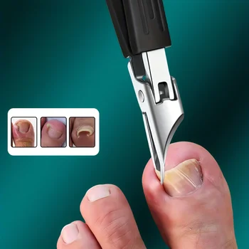 Robuster Edelstahl-Nagelknipser für eingewachsene Nägel mit Sicherheits-Softgriff, ultrascharfer