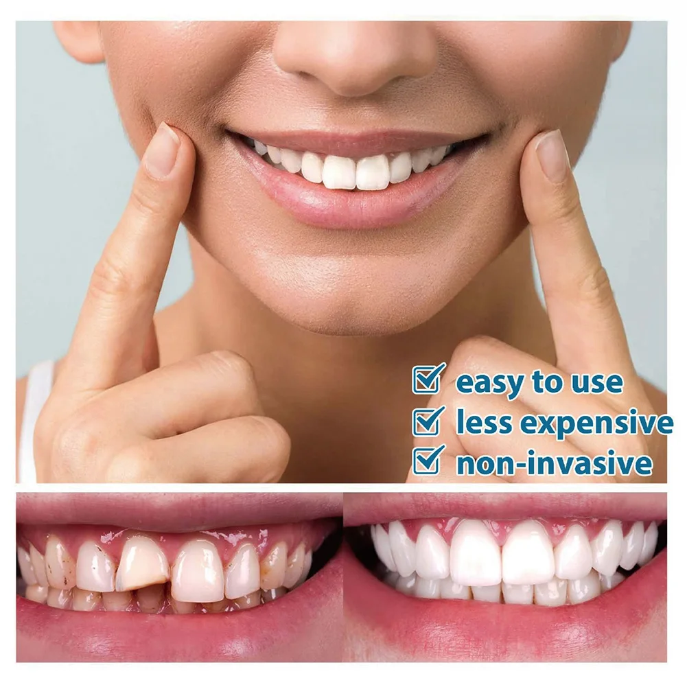 A1 A2 A3 Dental Composite Resin Nanometer Massives Harz – Bild 4