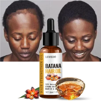 Lewedo Naturals Batana-Öl, schnelles Haarwachstum für Männer und Frauen, reines Batana-Öl, nährt glänzendes