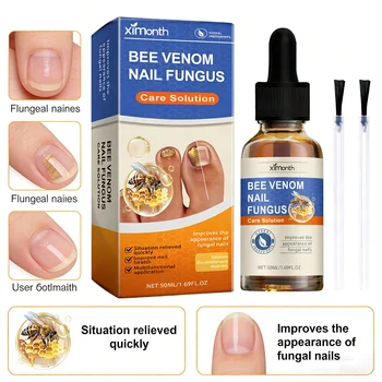 Nagelpilz-Pflegelösung Anti-Infektions-Onychomykose-Reparatur für Beschädigte Rissige Hand- und Fußnägel