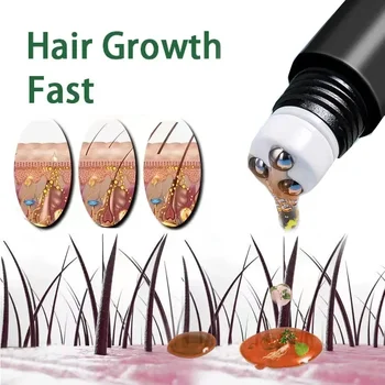 Biotin Schnelles Haarwuchsöl Pflegeprodukte Kopfhaut-Massage-Behandlungen Anti-Haarausfall Effektives